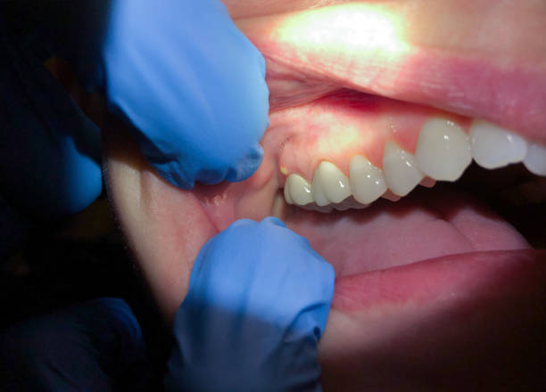 Best Emergency Treatment for Toothache in Tilton Northfield, NH
